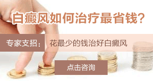影响白癜风治疗费用的因素