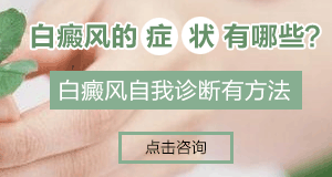 颈部白癜风如何治疗