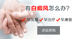 面部白癜风能不能治好