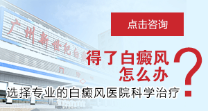 青少年白癜风如何防治